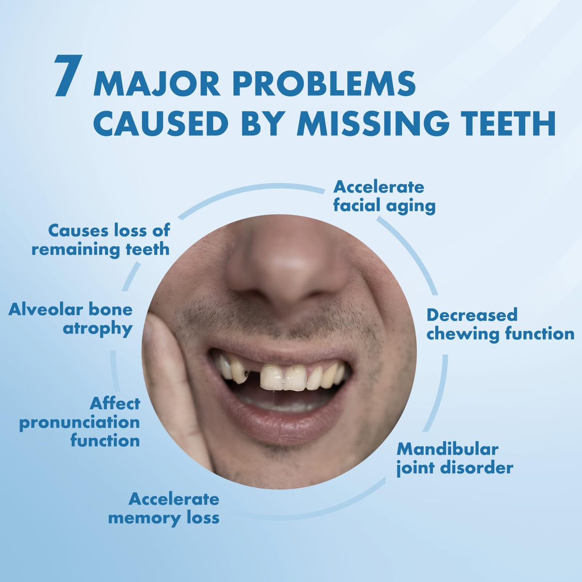 Custom Removable Dentures Set (1 Tooth) C944860