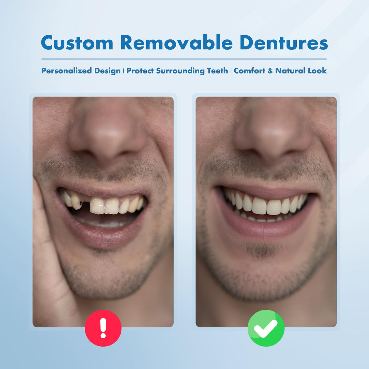 Custom Removable Dentures Set (1 Tooth) C944860